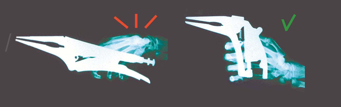 ergorgrip-radiografias